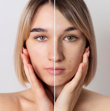 Works on Pigmentation and Spots