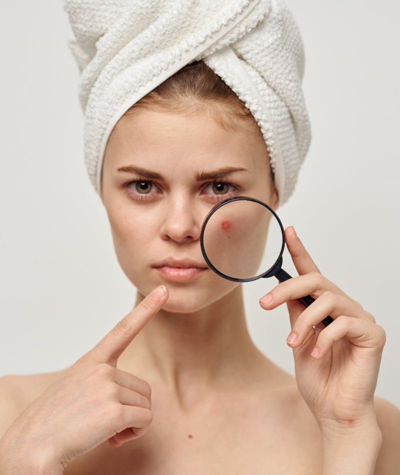 dBasic Acne Prone Skin Kit
