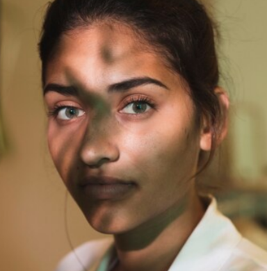 It works on Pigmentation